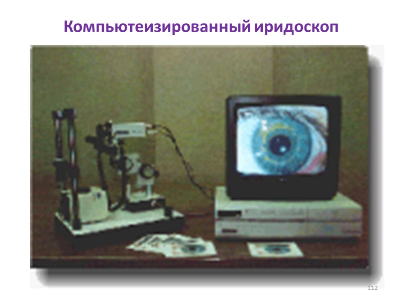 Компьютеизированный иридоскоп 112